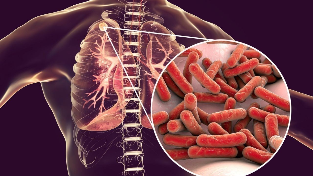 मंडी में गवर्नर ने TB-Free इंडिया योजना के तहत आयुष्मान आरोग्य कैंप आयोजित किया