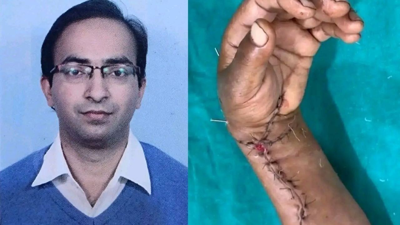 एम्स बिलासपुर में सात घंटे की सर्जरी से कटा हाथ फिर जोड़ा